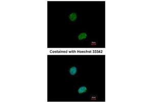 ICC/IF Image Immunofluorescence analysis of paraformaldehyde-fixed HeLa, using Ataxin 3, antibody at 1:500 dilution. (Ataxin 3 抗体)
