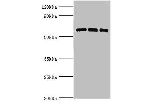 Western Blotting (WB) image for anti-Protein Kinase, AMP-Activated, alpha 2 Catalytic Subunit (PRKAA2) (AA 343-552), (Catalytic Subunit alpha) antibody (ABIN7142679)