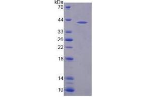 SDS-PAGE analysis of Human NAT8L Protein. (NAT8L 蛋白)