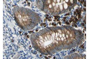 ABIN6267024 at 1/100 staining human Appendix tissue sections by IHC-P. (SDC4 抗体  (C-Term))