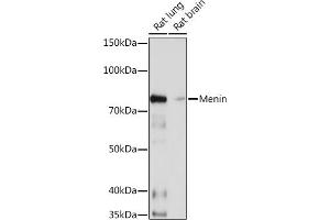 Western blot analysis of extracts of various cell lines, using Menin Rabbit mAb (ABIN7268697) at 1:1000 dilution. (Menin 抗体)