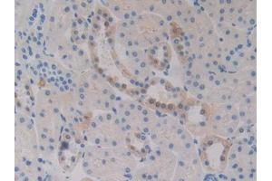 DAB staining on IHC-P; Samples: Rat Kidney Tissue (FCAR 抗体  (AA 51-280))