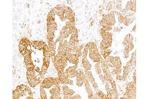 Immunohistochemistry (IHC) image for anti-Transmembrane Protein 173 (TMEM173) (C-Term) antibody (ABIN7795818) (Recombinant STING/TMEM173 抗体  (C-Term))