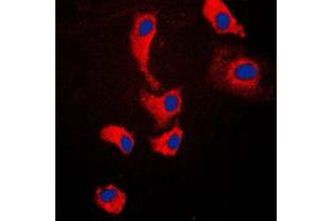 Immunofluorescent analysis of MYD88 staining in Jurkat cells. (MYD88 抗体  (Center))