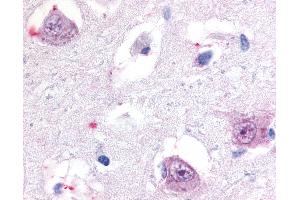 Anti-ROR Beta antibody IHC of human brain, thalamus. (RORB 抗体  (Hinge Region))