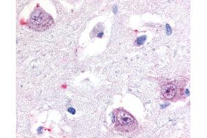 Anti-ROR Beta antibody IHC of human brain, thalamus. (RORB 抗体  (Hinge Region))