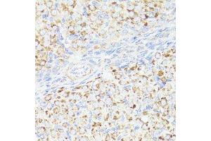 Immunohistochemistry (Paraffin-embedded Sections) (IHC (p)) image for anti-Receptor tyrosine-protein kinase erbB-2 (ErbB2/Her2) (C-Term) antibody (ABIN6140248)