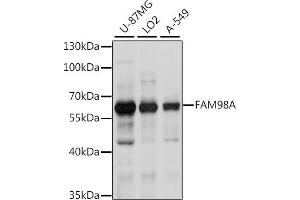 Western blot analysis of extracts of various cell lines, using FA antibody (ABIN7267121) at 1:1000 dilution. (FAM98A 抗体  (AA 1-220))