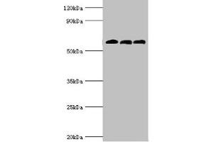 Western blot All lanes: 4-aminobutyrate aminotransferase, mitochondrial antibody at 10 μg/mL Lane 1: Rat liver tissue Lane 2: Mouse pancreatic tissue Lane 3: Mouse kidney tissue Secondary Goat polyclonal to rabbit IgG at 1/10000 dilution Predicted band size: 56 kDa Observed band size: 56 kDa (ABAT 抗体  (AA 29-300))