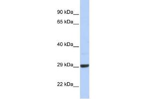 C10ORF56 antibody used at 1 ug/ml to detect target protein. (ZCCHC24 抗体  (Middle Region))