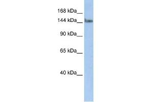 WB Suggested Anti-TCERG1 Antibody Titration:  0. (TCERG1 抗体  (N-Term))