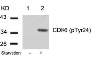 Image no. 2 for anti-Cyclin-Dependent Kinase 6 (CDK6) (pTyr24) antibody (ABIN319289) (CDK6 抗体  (pTyr24))
