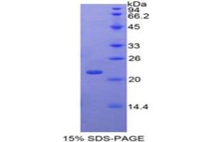 SDS-PAGE (SDS) image for TAF12 RNA Polymerase II, TATA Box Binding Protein (TBP)-Associated Factor, 20kDa (TAF12) (AA 1-161) protein (His tag) (ABIN2126929)
