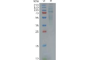 SDS-PAGE (SDS) image for Growth Arrest-Specific 6 (GAS6) (AA 31-678) protein (His tag) (ABIN7092775)