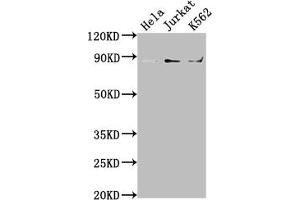 Western Blot Positive WB detected in: Hela whole cell lysate, Jurkat whole cell lysate, K562 whole cell lysate All lanes: IKBKB antibody at 1:2000 Secondary Goat polyclonal to rabbit IgG at 1/50000 dilution Predicted band size: 87, 86, 30, 80 kDa Observed band size: 87 kDa