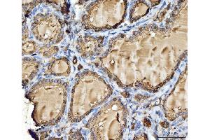 IHC analysis of Cathepsin B/CTSB using anti-Cathepsin B/CTSB antibody (ABIN7601692).