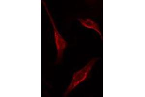 ABIN6275361 staining HT29 cells by IF/ICC. (PNN 抗体  (Internal Region))