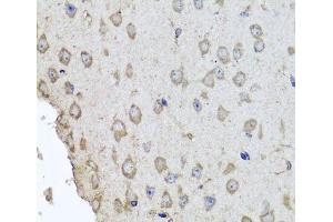 Immunohistochemistry of paraffin-embedded Mouse brain using HBA2 Polyclonal Antibody at dilution of 1:100 (40x lens). (HBa2 抗体)