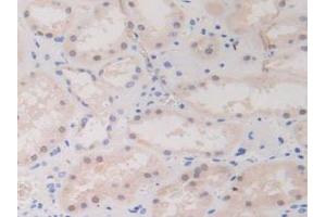 IHC-P analysis of Human Kidney Tissue, with DAB staining. (BIRC2 抗体  (AA 1-497))