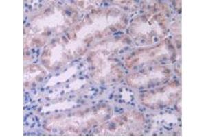 IHC-P analysis of Human Kidney Tissue, with DAB staining. (IL-2 抗体  (AA 21-153))