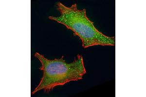 Immunofluorescent analysis of 4 % paraformaldehyde-fixed, 0. (BMI1 抗体)