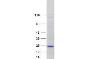 Validation with Western Blot (TMEM80 Protein (Transcript Variant 2) (Myc-DYKDDDDK Tag))