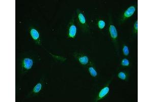 IF analysis of Emerin using anti-Emerin antibody (ABIN4886569).