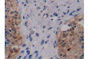 Immunohistochemistry (IHC) image for anti-Receptor tyrosine-protein kinase erbB-2 (ErbB2/Her2) (AA 376-578) antibody (ABIN7426373)