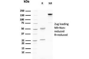 SDS-PAGE Analysis Purified Desmoglein-3 Mouse Monoclonal Antibody (DSG3/2796). (Desmoglein 3 抗体  (AA 379-491))