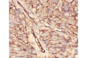 IHC-P: CD34 antibody testing of human lung cancer tissue