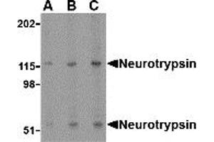 Western Blotting (WB) image for anti-Protease, serine, 12 (Neurotrypsin, Motopsin) (PRSS12) (N-Term) antibody (ABIN1031478)