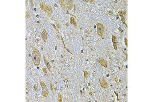 Immunohistochemistry of paraffin-embedded mouse brain using ITGA2 Antibody. (ITGA2 抗体)