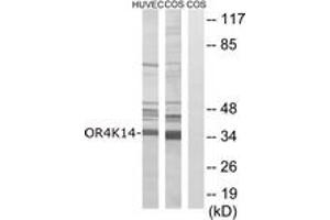 Western blot analysis of extracts from COS7/HuvEc cells, using OR4K14 Antibody. (OR4K14 抗体  (AA 261-310))