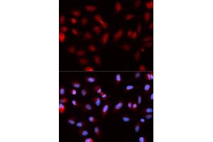 Immunofluorescence analysis of U2OS cells using BIRC5 antibody. (Survivin 抗体  (AA 1-142))