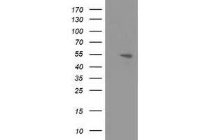 Western Blotting (WB) image for anti-Amyloid beta (A4) Precursor Protein-Binding, Family B, Member 3 (APBB3) antibody (ABIN1496654) (APBB3 抗体)
