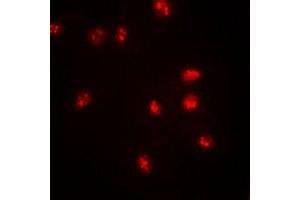 Immunofluorescent analysis of BAF57 staining in SW620 cells. (SMARCE1 抗体)