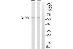 Western blot analysis of extracts from A549 cells and K562 cells, using GLRB antibody. (GLRB 抗体)