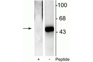 Western blot of recombinant Elk-1 showing specific immunolabeling of the ~46 kDa Elk-1 phosphorylated at Ser383 in the right lane (-). (ELK1 抗体  (pSer383))