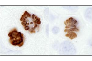 Immunohistochemistry (IHC) image for anti-Histone H3 (H3) (pSer10) antibody (ABIN7449558) (Histone 3 抗体  (pSer10))