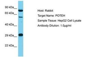 Image no. 1 for anti-POTE Ankyrin Domain Family, Member H (POTEH) (AA 421-470) antibody (ABIN6750592) (POTEH 抗体  (AA 421-470))