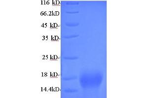 SDS-PAGE (SDS) image for Pvt-Associated Transcript (PAT) (AA 1-183), (full length) protein (His tag) (ABIN5714048)