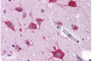 Human Brain, Cortex: Formalin-Fixed, Paraffin-Embedded (FFPE) (FAM59A 抗体  (C-Term))
