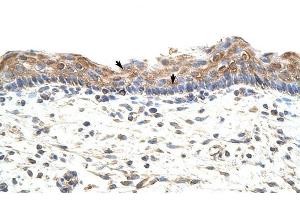 GNB1L antibody was used for immunohistochemistry at a concentration of 4-8 ug/ml to stain Squamous epithelial cells (arrows) in Human Skin.