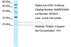 Western Blotting (WB) image for anti-Cyclin-Dependent Kinase 7 (CDK7) (C-Term) antibody (ABIN2792153) (CDK7 抗体  (C-Term))
