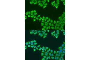 Immunofluorescence analysis of U2OS cells using F1 antibody (ABIN6131059, ABIN6137331, ABIN6137332 and ABIN6223561) at dilution of 1:100.