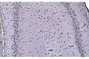 IHC analysis of CBX1/HP1 beta using anti-CBX1/HP1 beta antibody (ABIN7602012).