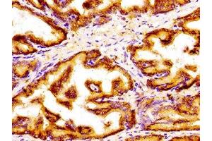 Immunohistochemistry of paraffin-embedded human prostate tissue using ABIN7154296 at dilution of 1:100 (GOLPH3 抗体  (AA 16-150))
