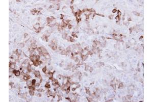 IHC-P Image Immunohistochemical analysis of paraffin-embedded DU-145 xenograft, using ALDH1A1, antibody at 1:500 dilution. (ALDH1A1 抗体  (C-Term))