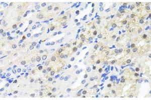 Immunohistochemistry of paraffin-embedded Mouse kidney using TRIM27 Polyclonal Antibody at dilution of 1:100 (40x lens). (TRIM27 抗体)