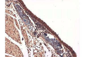 Immunohistochemistry (IHC) image for anti-Solute Carrier Family 5 (Sodium/iodide Cotransporter), Member 5 (SLC5A5) (AA 468-643) antibody (HRP) (ABIN2484442)